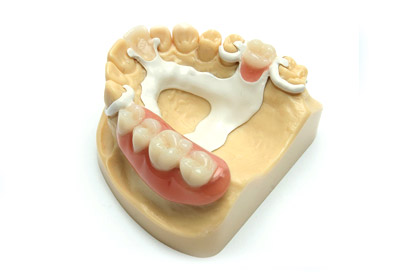 Ацеталовый протез