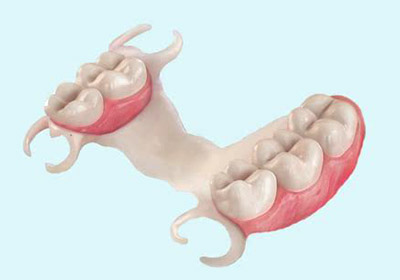 протез Квадротти